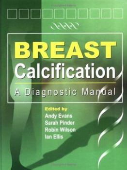 Hardcover Breast Calcification: A Diagnostic Manual Book