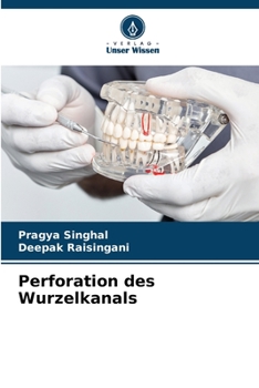 Paperback Perforation des Wurzelkanals [German] Book