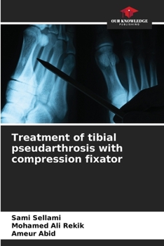 Paperback Treatment of tibial pseudarthrosis with compression fixator Book