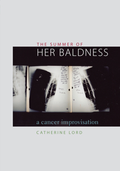 Paperback The Summer of Her Baldness: A Cancer Improvisation Book