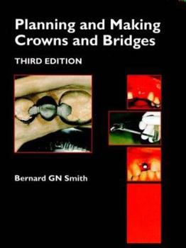 Hardcover Planning and Making Crowns and Bridges Planning and Making Crowns and Bridges Book