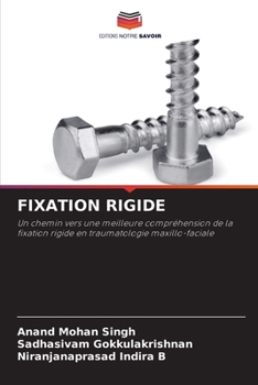 Paperback Fixation Rigide [French] Book