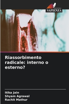 Paperback Riassorbimento radicale: interno o esterno? [Italian] Book