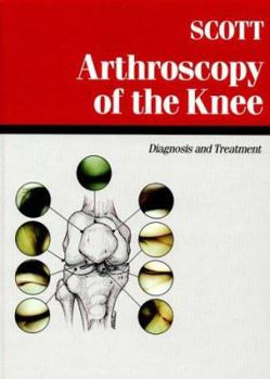 Hardcover Arthroscopy of the Knee: Diagnosis & Treatment Book