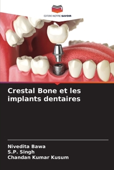 Paperback Crestal Bone et les implants dentaires [French] Book