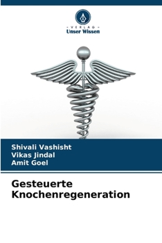 Paperback Gesteuerte Knochenregeneration [German] Book