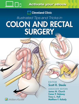 Paperback Cleveland Clinic Illustrated Tips and Tricks in Colon and Rectal Surgery Book