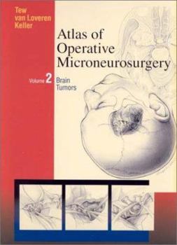 Hardcover Atlas of Operative Microneurosurgery, Vol. 2: Brain Tumors Book