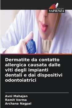 Dermatite da contatto allergica causata dalle viti degli impianti dentali e dai dispositivi odontoiatrici (Italian Edition)
