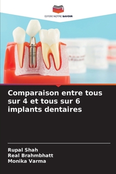 Paperback Comparaison entre tous sur 4 et tous sur 6 implants dentaires [French] Book