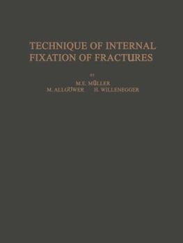 Paperback Technique of Internal Fixation of Fractures Book