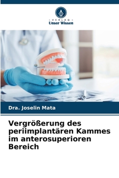 Paperback Vergrößerung des periimplantären Kammes im anterosuperioren Bereich [German] Book