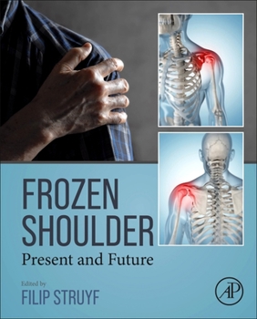 Hardcover Frozen Shoulder: Present and Future Book