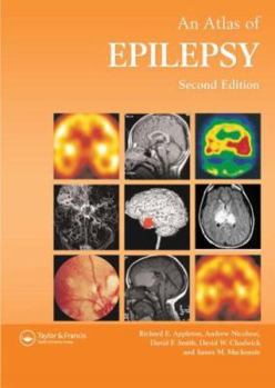 Hardcover Atlas of Epilepsy Book