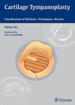 Hardcover Cartilage Tympanoplasty: Classification of Methods - Techniques - Results Book