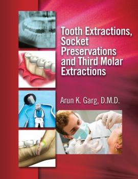 Hardcover Tooth Extractions, Socket Preservations and Third Molar Extractions Book