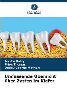 Paperback Umfassende Übersicht über Zysten im Kiefer [German] Book