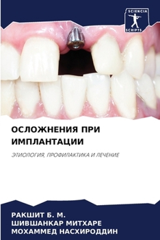 Paperback ОСЛОЖНЕНИЯ ПРИ ИМПЛАНТА& [Russian] Book