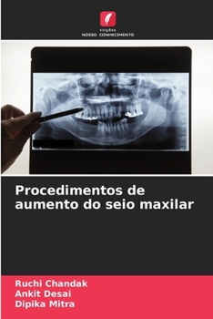 Paperback Procedimentos de aumento do seio maxilar [Portuguese] Book