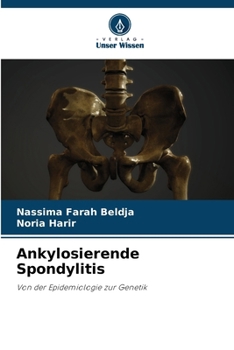 Paperback Ankylosierende Spondylitis [German] Book