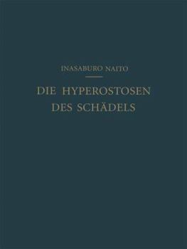 Paperback Die Hyperostosen Des Schädels [German] Book