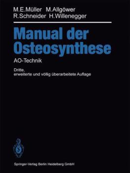 Paperback Manual Der Osteosynthese: Ao-Technik [German] Book