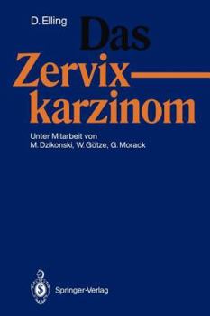 Paperback Das Zervixkarzinom [German] Book