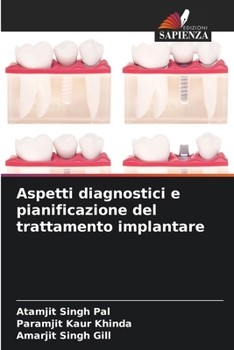 Aspetti diagnostici e pianificazione del trattamento implantare (Italian Edition)