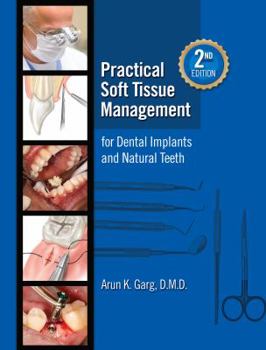 Hardcover Practical Soft Tissue Management For Dental Implants and Natural Teeth, 2nd Editoin Book