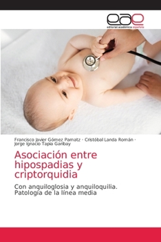 Paperback Asociación entre hipospadias y criptorquidia [Spanish] Book