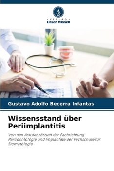 Paperback Wissensstand über Periimplantitis [German] Book