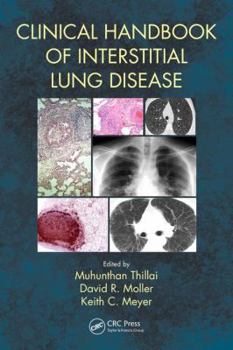 Paperback Clinical Handbook of Interstitial Lung Disease Book