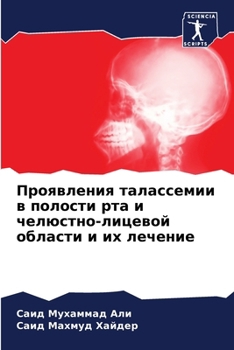 Paperback Проявления талассемии в [Russian] Book