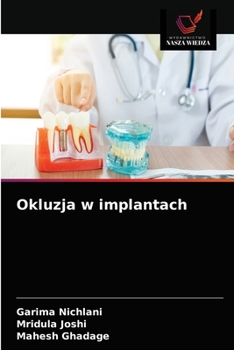 Paperback Okluzja w implantach [Polish] Book