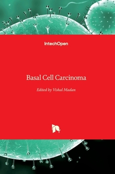 Hardcover Basal Cell Carcinoma Book