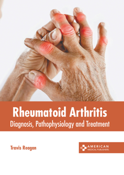 Hardcover Rheumatoid Arthritis: Diagnosis, Pathophysiology and Treatment Book