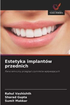 Estetyka implantów przednich (Polish Edition)