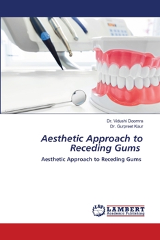 Paperback Aesthetic Approach to Receding Gums Book