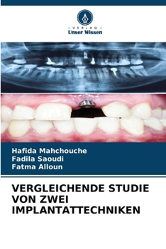 Paperback Vergleichende Studie Von Zwei Implantattechniken [German] Book