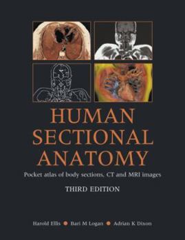 Paperback Human Sectional Anatomy Pocket Atlas of Body Sections, CT and MRI Images Book