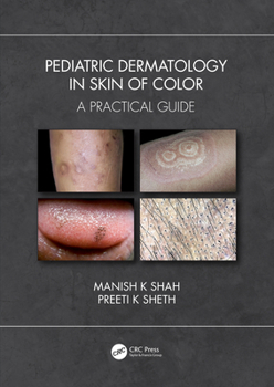 Paperback Pediatric Dermatology in Skin of Color: A Practical Guide Book