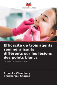 Efficacité de trois agents reminéralisants différents sur les lésions des points blancs: Un essai clinique contrôlé