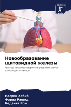 Paperback Новообразование щитови&# [Russian] Book