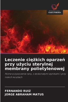 Leczenie ciezkich oparzen przy uzyciu sterylnej membrany polietylenowej (Polish Edition)
