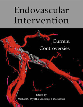 Paperback Endovascular Intervention: Current Controversies Book