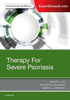 Hardcover Therapy for Severe Psoriasis Book