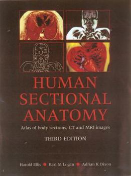 Hardcover Human Sectional Anatomy: Atlas of Body Sections, CT and MRI Images Book