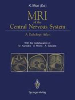 Hardcover MRI of the Central Nervous System: A Pathology Atlas Book