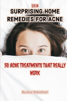 Paperback Skin: SURPRISING HOME REMEDIES FOR ACNE: 50 ACNE TREATMENTS THAT REALLY WORK, Natural Remedies To Cure Acne (Natural Cures, Book