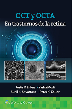 Paperback Oct Y Octa En Trastornos de la Retina [Spanish] Book